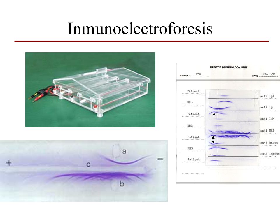 Qu Es La Inmunoelectrofor Sis Archivos Udear Unidad De